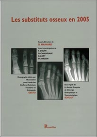 Image de Les substituts osseux en 2005
