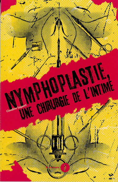 Picture of La nymphoplastie - Une chirurgie de l’intime