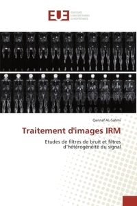 Picture of Traitement d'images IRM