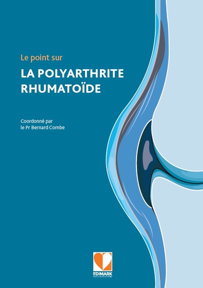 Image de Le point sur la polyarthrite rhumatoïde