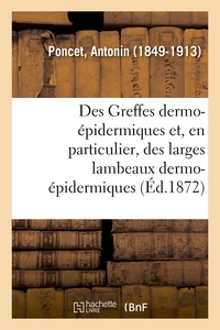 Picture of Des Greffes dermo-épidermiques et, en particulier, des larges lambeaux dermo-épidermiques