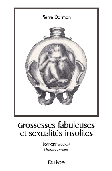 Image de Grossesses fabuleuses et sexualités insolites (XVIe-XIXe siècles)