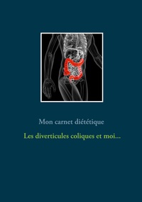 Picture of Mon carnet diététique : les diverticules coliques et moi...