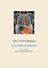 Image de Le b.a.-ba de la diététique pour l'ulcère duodénal