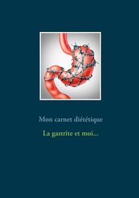 Image de Mon carnet diététique : la gastrite et moi
