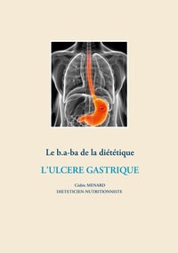 Image de Le b.a-ba de la diététique pour l'ulcère gastrique