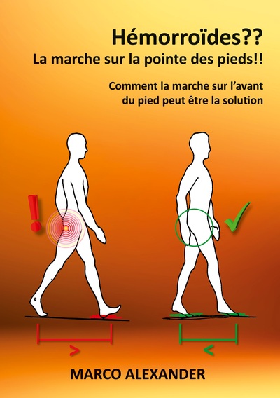 Image de Hémorroïdes ?? La marche sur la pointe des pieds !