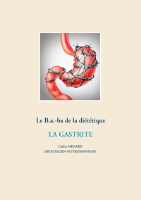 Image de Le B.a.-ba diététique de la gastrite