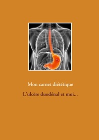 Image de Mon carnet diététique : l'ulcère duodénal et moi...