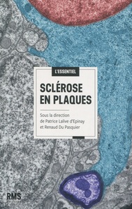 Image de SCLEROSE EN PLAQUES