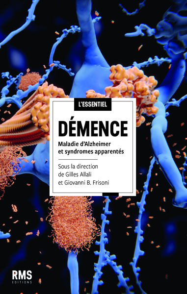 Image de DEMENCE : MALADIE D ALZHEIMER ET SYNDROMES APPARENTES.