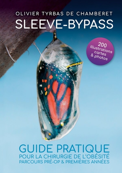 Picture of Sleeve - Bypass : Guide pratique pour la chirurgie de l'obésité