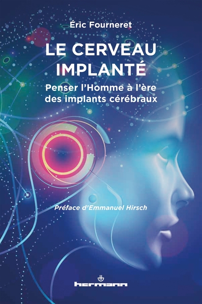 Image de Le cerveau implanté