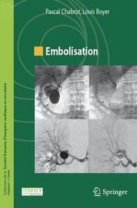 Image de Embolisation