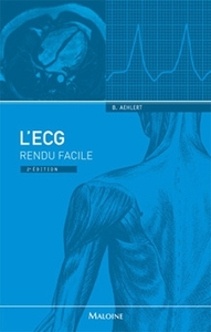 Image de l'ecg rendu facile, 2e ed.