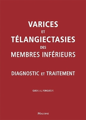 Image de Varices et teleangiecasties des membres inferieurs