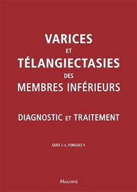 Image de Varices et teleangiecasties des membres inferieurs