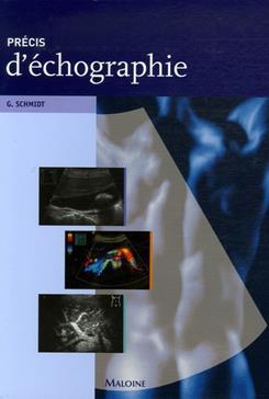 Picture of precis d'echographie