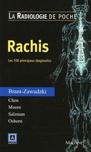 Image de RADIOLOGIE DE POCHE - RACHIS. LES 100 PRINCIPAUX DIAGNOSTICS