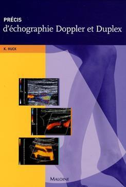 Image de precis d'echographie doppler et duplex
