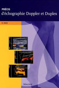 Image de precis d'echographie doppler et duplex