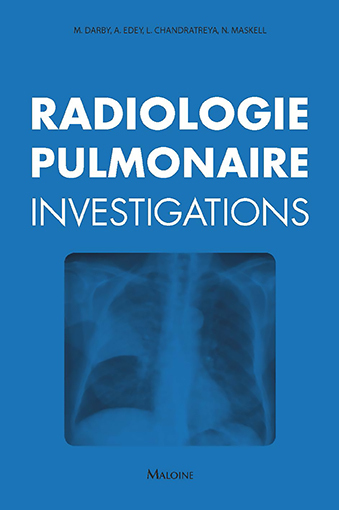 Image de Radiologie pulmonaire : investigations