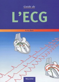 Image de GUIDE DE L'ECG