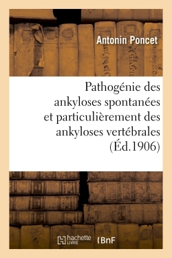 Picture of Pathogénie des ankyloses spontanées et particulièrement des ankyloses vertébrales