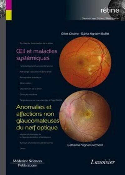 Picture of Oeil et maladies systémiques / Anomalies et affections non glaucomateuses du nerf optique (volume 5 - coffret Rétine)