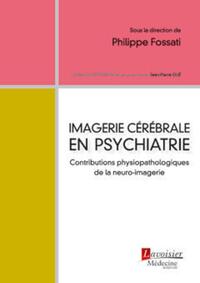 Picture of Imagerie cérébrale en psychiatrie