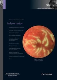 Picture of Inflammation (volume 4 - coffret Rétine)