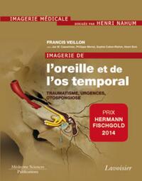 Picture of Imagerie de l'oreille et de l'os temporal - Volume 3. Traumatologie, urgences, otospongiose