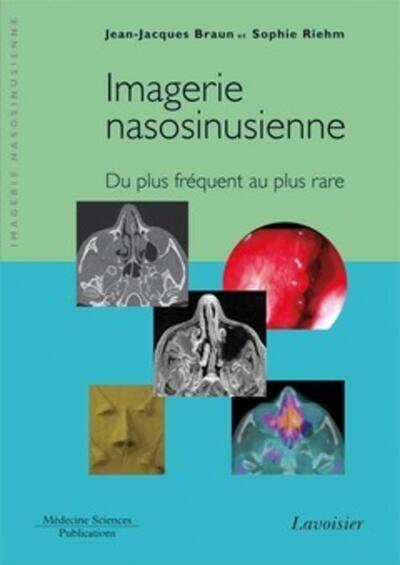 Picture of Imagerie nasosinusienne