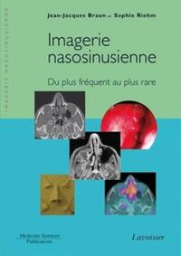 Picture of Imagerie nasosinusienne