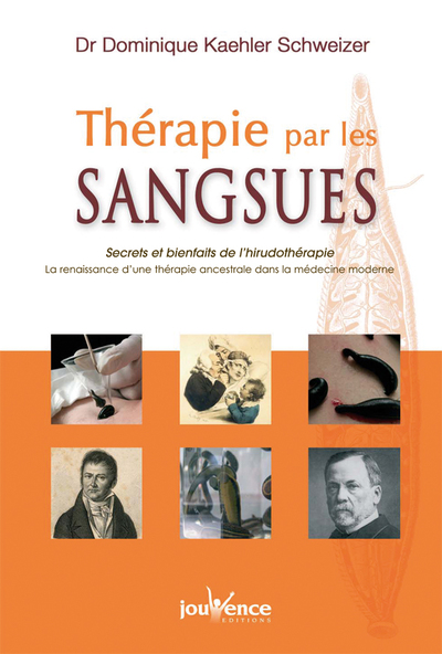 Image de n°248 Thérapie par les sangsues