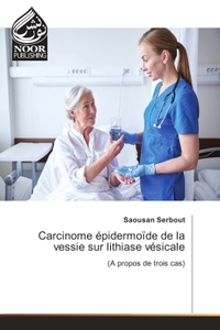 Image de Carcinome epidermoïde de la vessie sur lithiase vesicale
