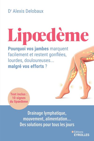 Picture of Lipoedème : pourquoi vos jambes marquent facilement et restent gonflées, lourdes, douloureuses... malgré vos efforts ?