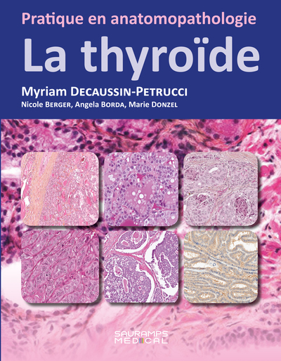 Picture of La thyroïde