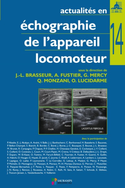Picture of ACTUALITES EN ECHOGRAPIE DE L APPAREIL LOCOMOTEUR T14
