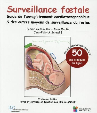 Picture of SURVEILLANCE FOETALE - GUIDE DE L'ENREGISTREMENT CARDIOTOCOGRAPHIQUE & AUTRES MO