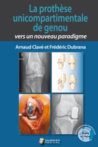 Picture of LA PROTHESE UNICOMPARTIMENTALE DE GENOU. VERS UN NOUVEAU PARADIGME