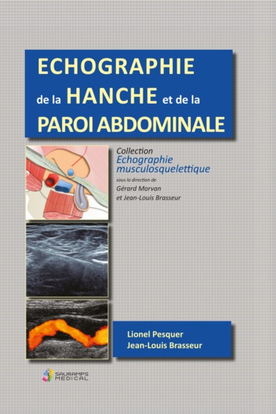 Picture of ECHOGRAPHIE DE  LA HANCHE ET DE LA PAROI ABDOMINALE