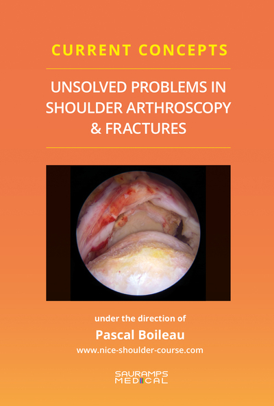 Image de Current concepts-Unsolved problems in shouhder. Arthroscopy & fractures