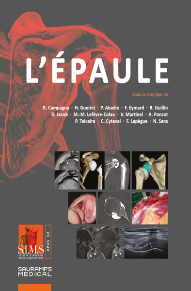 Image de L'épaule - SIMS 2026
