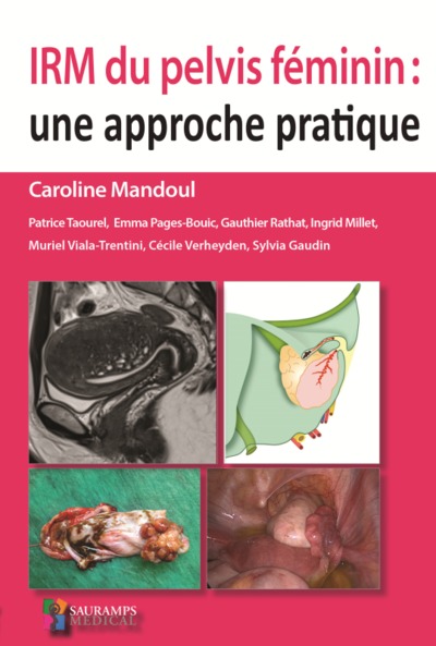Image de IRM DU PELVIS FEMININ : UNE APPROCHE PRATIQUE
