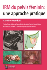 Image de IRM DU PELVIS FEMININ : UNE APPROCHE PRATIQUE