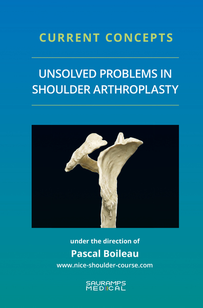 Image de Current concepts-Unsolved problems in shoulder. Arthroscopy