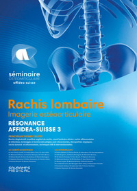 Image de RACHIS LOMBAIRE - RESONANCE - AFFIDEA SUISSE 3