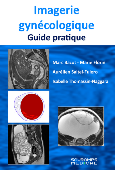 Image de IMAGERIE GYNECOLOGIQUE