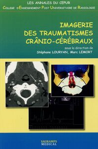 Image de IMAGERIE DES TRAUMATISMES CRANIO-CEREBRAUX